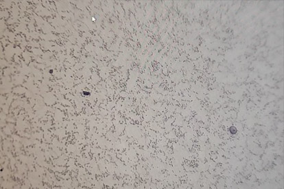 Detecção de fase metaloica-500 vezes a fase metaloica